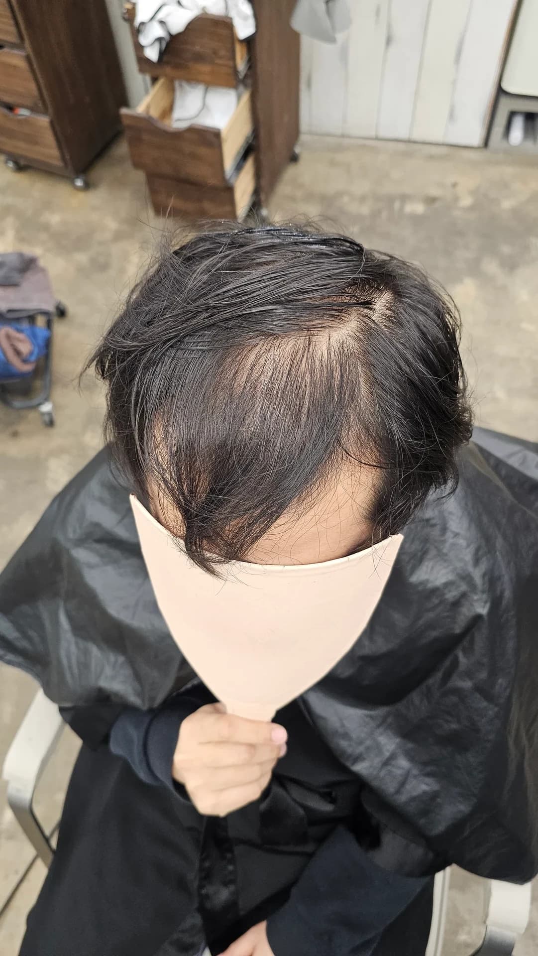 코로나 후 탈모, 안양에서 찾은 탈모 치트펌 솔루션