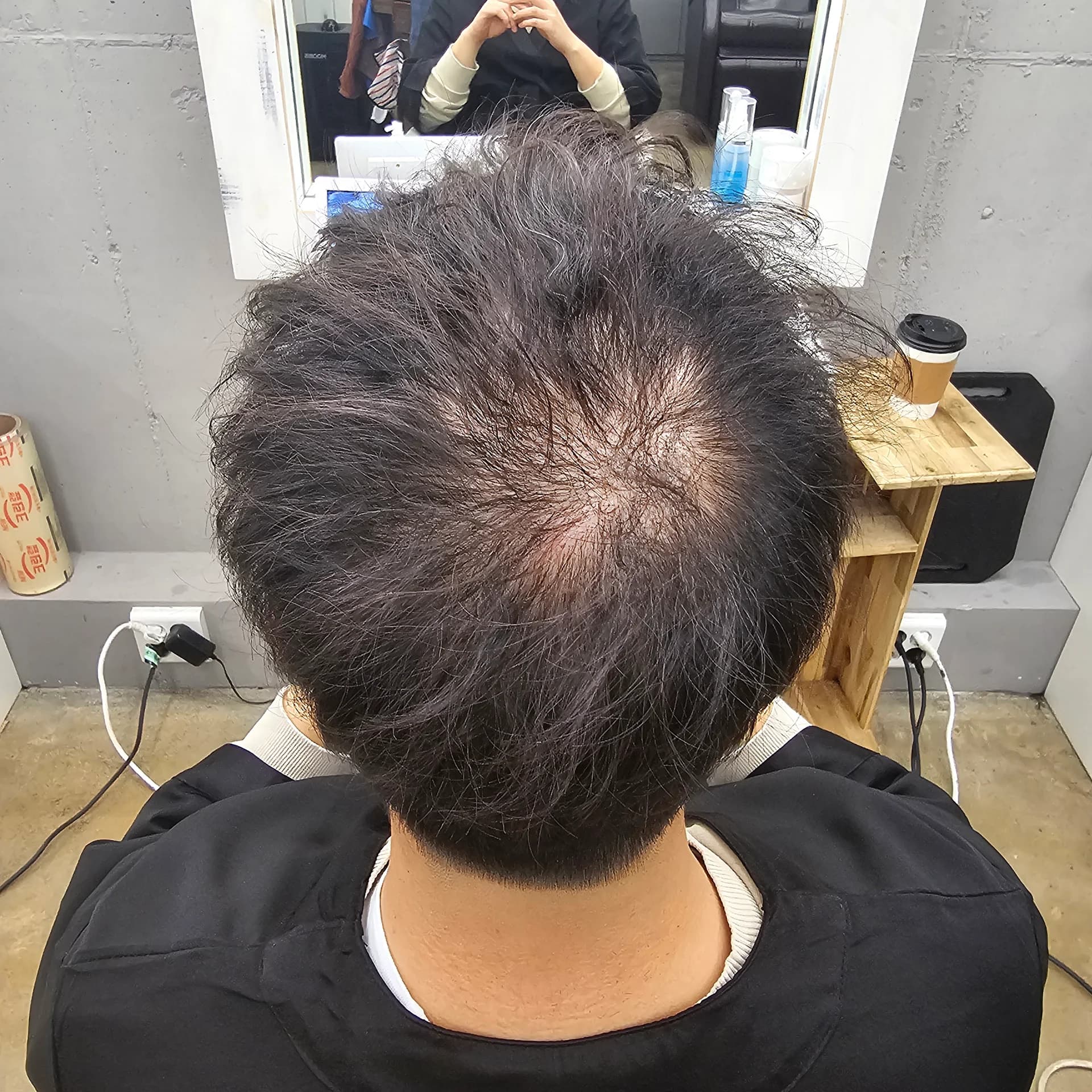 두피페인팅 (치트염색) 시술 전후 비교 - 리턴헤어