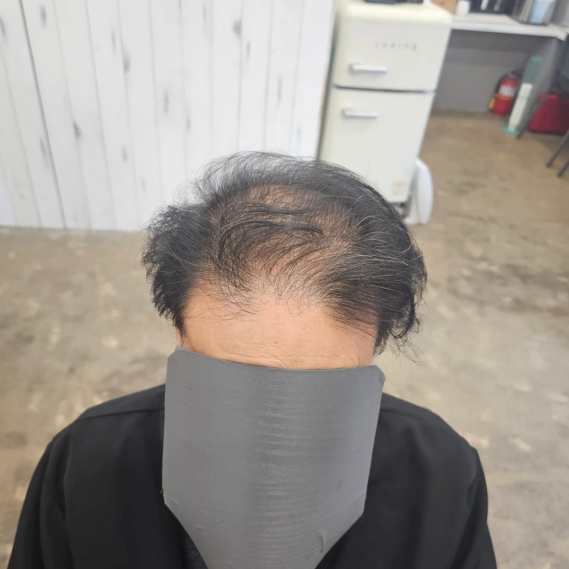 두피페인팅 (치트염색) 시술 전후 비교 - 리턴헤어