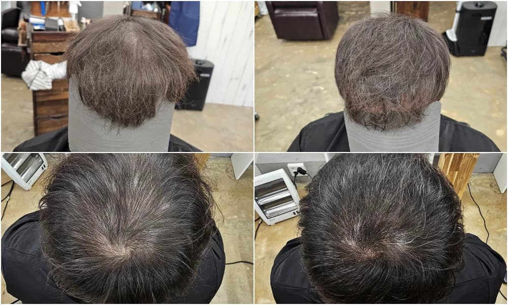 두피페인팅 (치트염색) 시술 전후 비교 - 리턴헤어