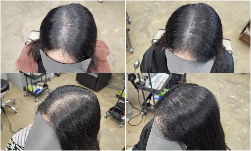 두피페인팅 (치트염색) 시술 전후 비교 - 리턴헤어