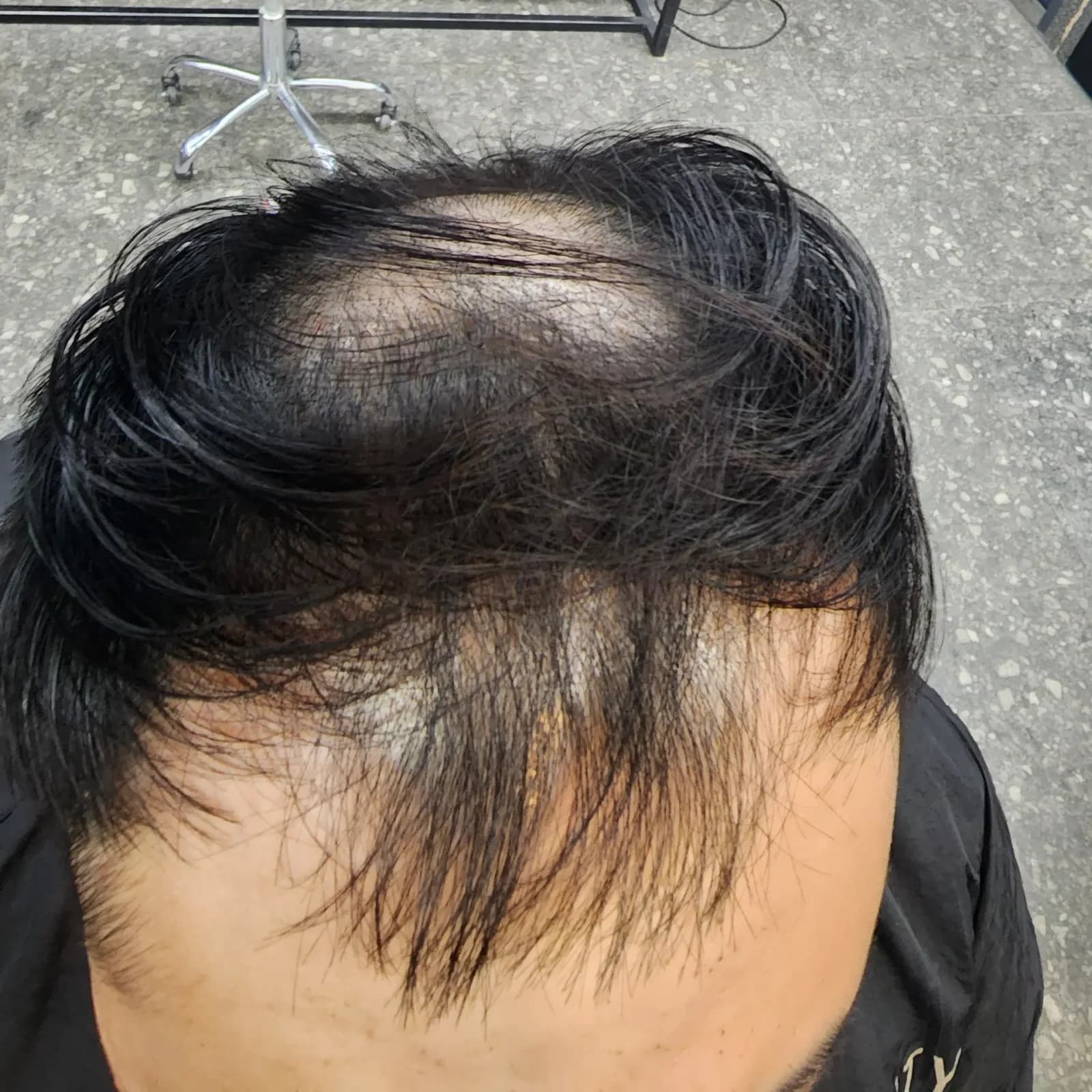 두피페인팅 (치트염색) 시술 전후 비교 - 리턴헤어