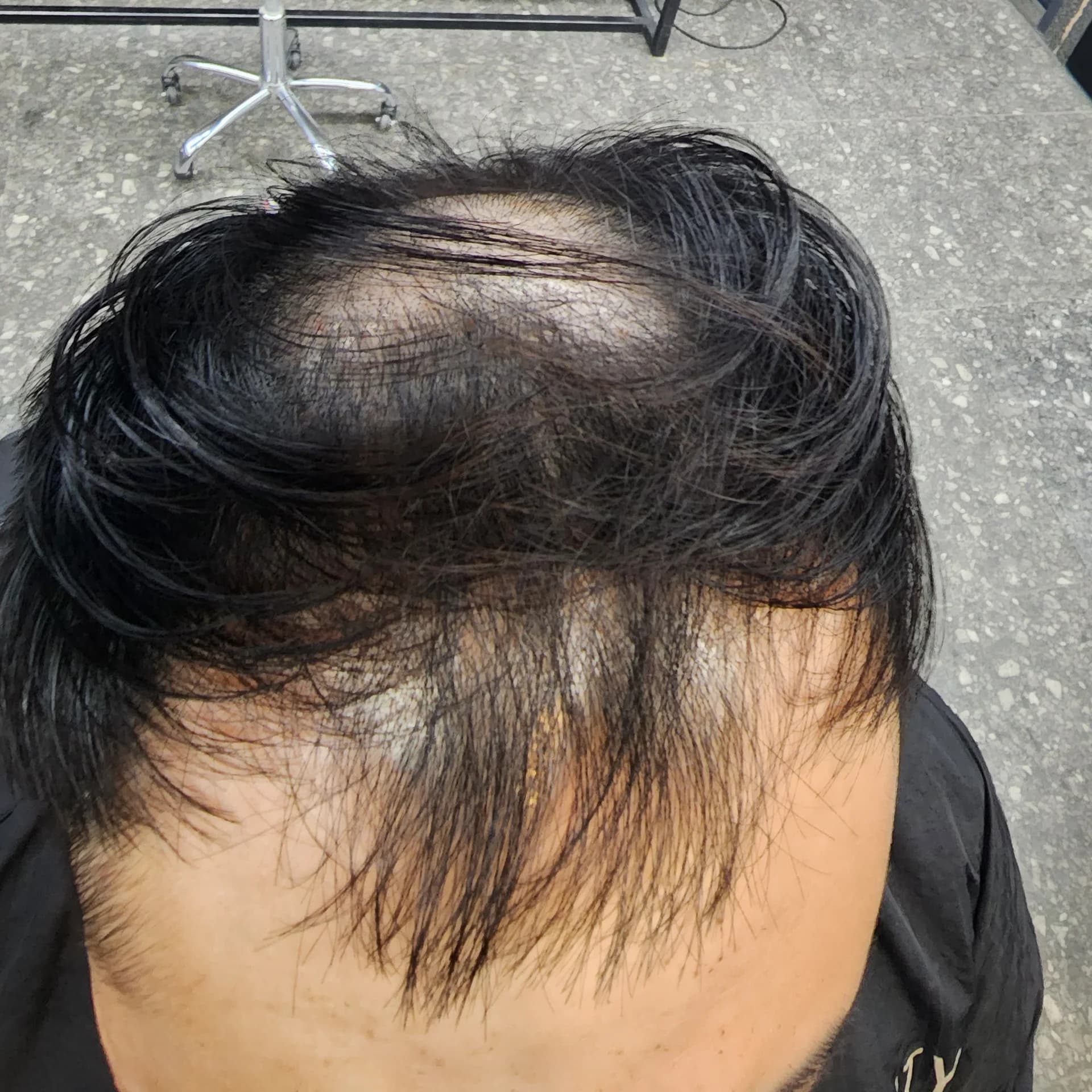 두피페인팅 (치트염색) 시술 전후 비교 - 리턴헤어