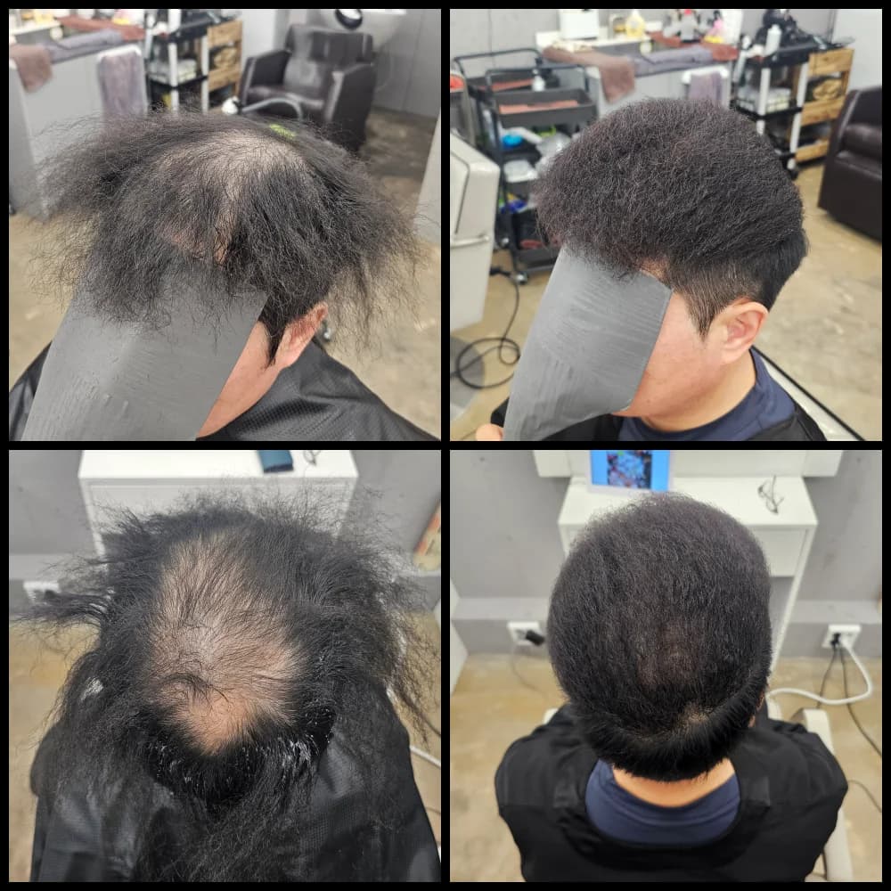 탈모 치트펌 파마 시술 전후 비교 - 리턴헤어