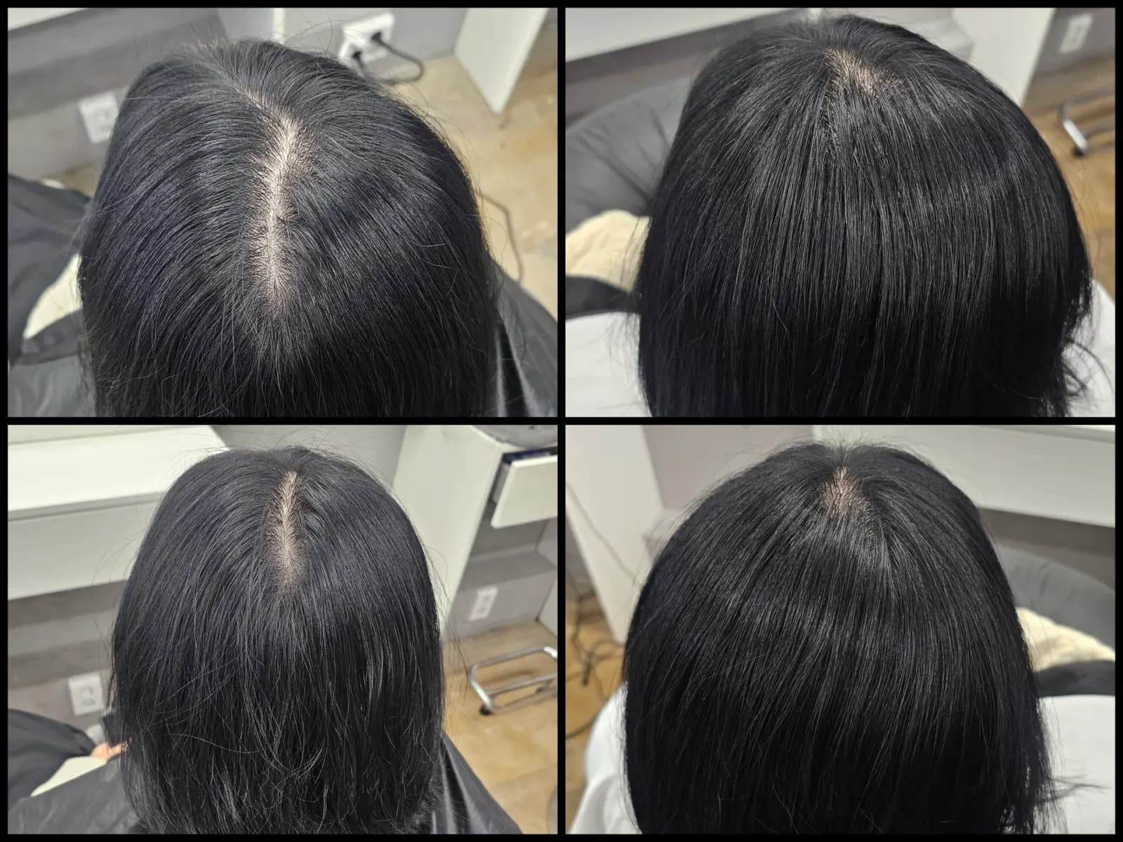 회춘펌 (뿌리볼륨 교정펌) 시술 전후 비교 - 리턴헤어