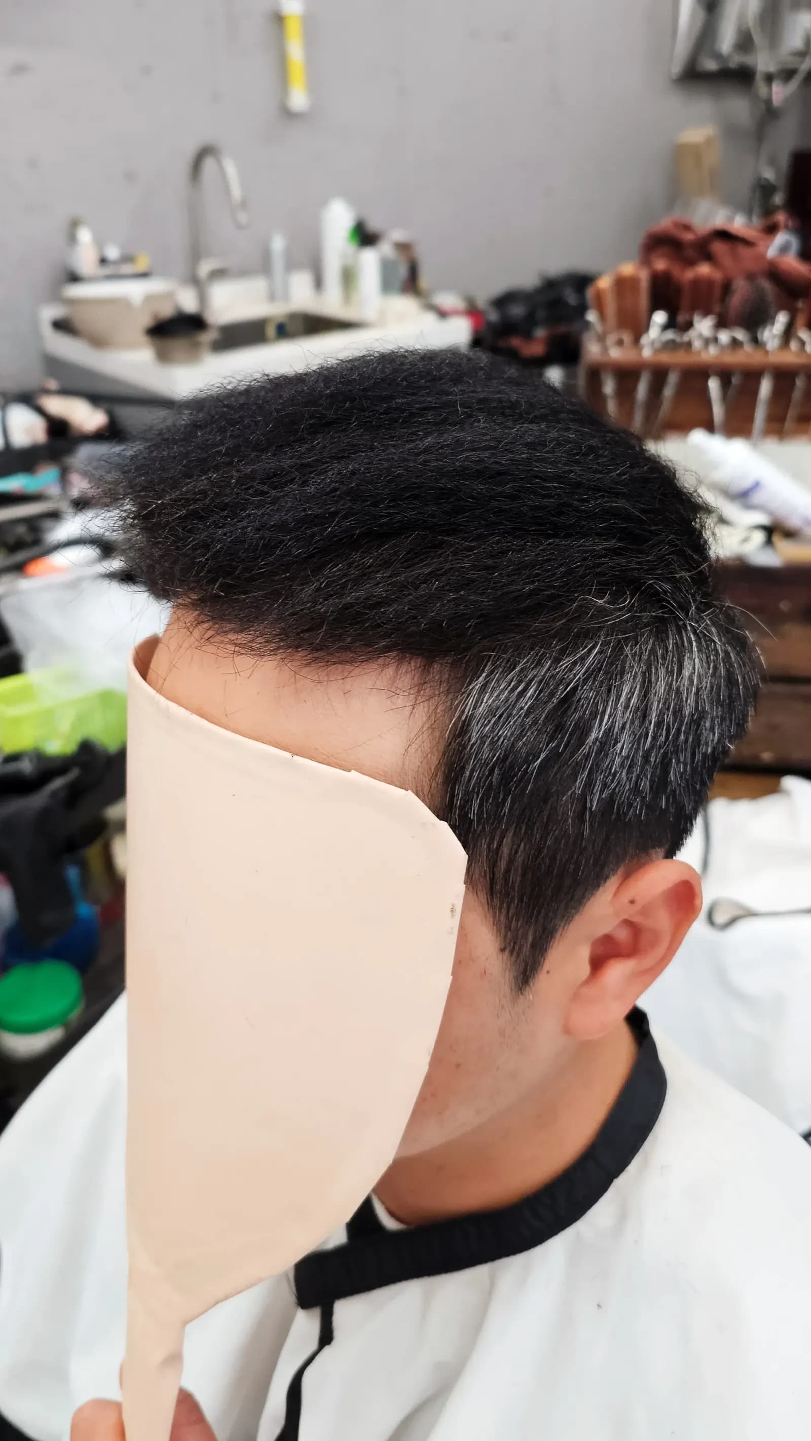 탈모 치트펌 파마 시술 전후 비교 - 리턴헤어