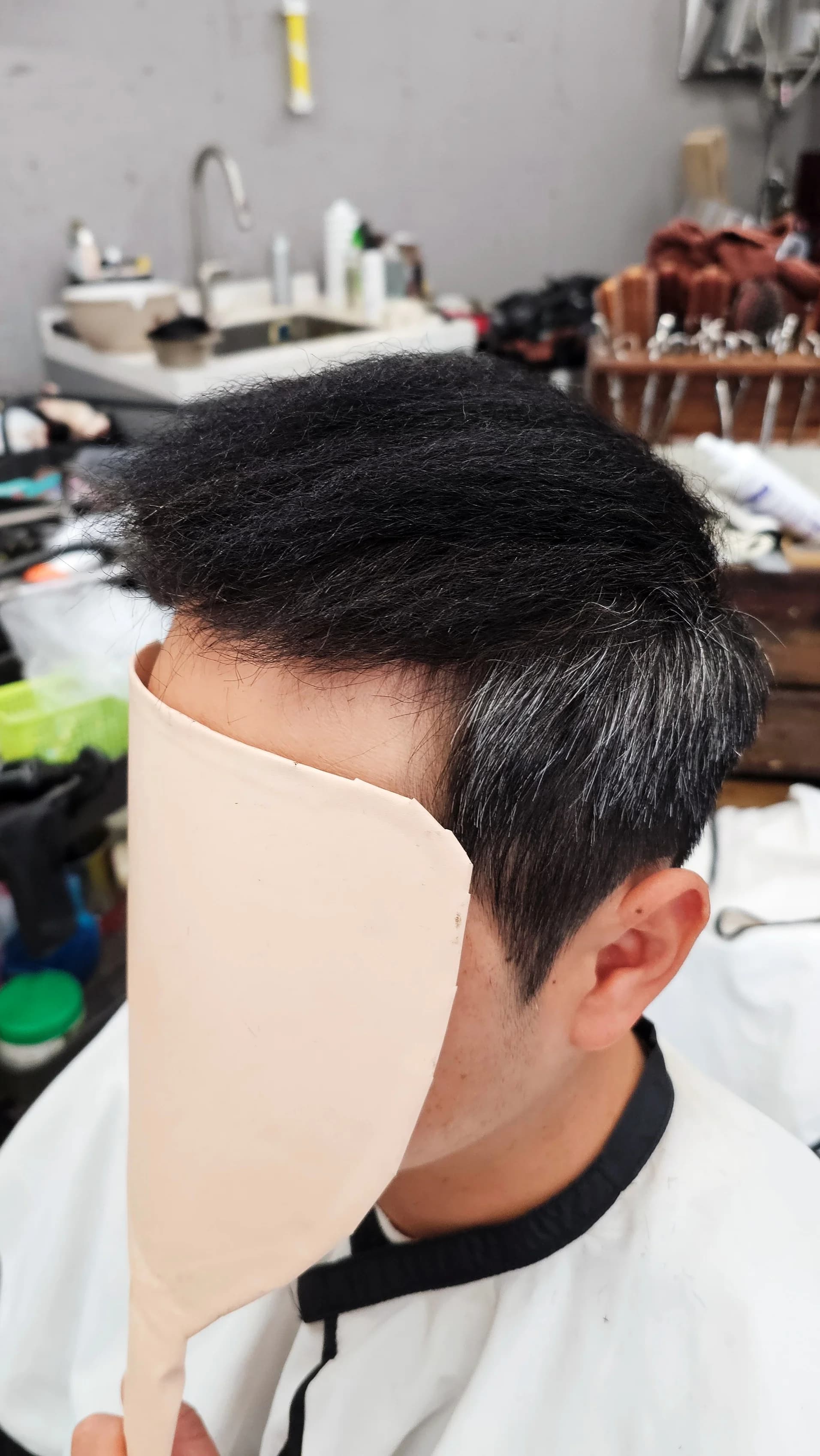 탈모 치트펌 파마 시술 전후 비교 - 리턴헤어