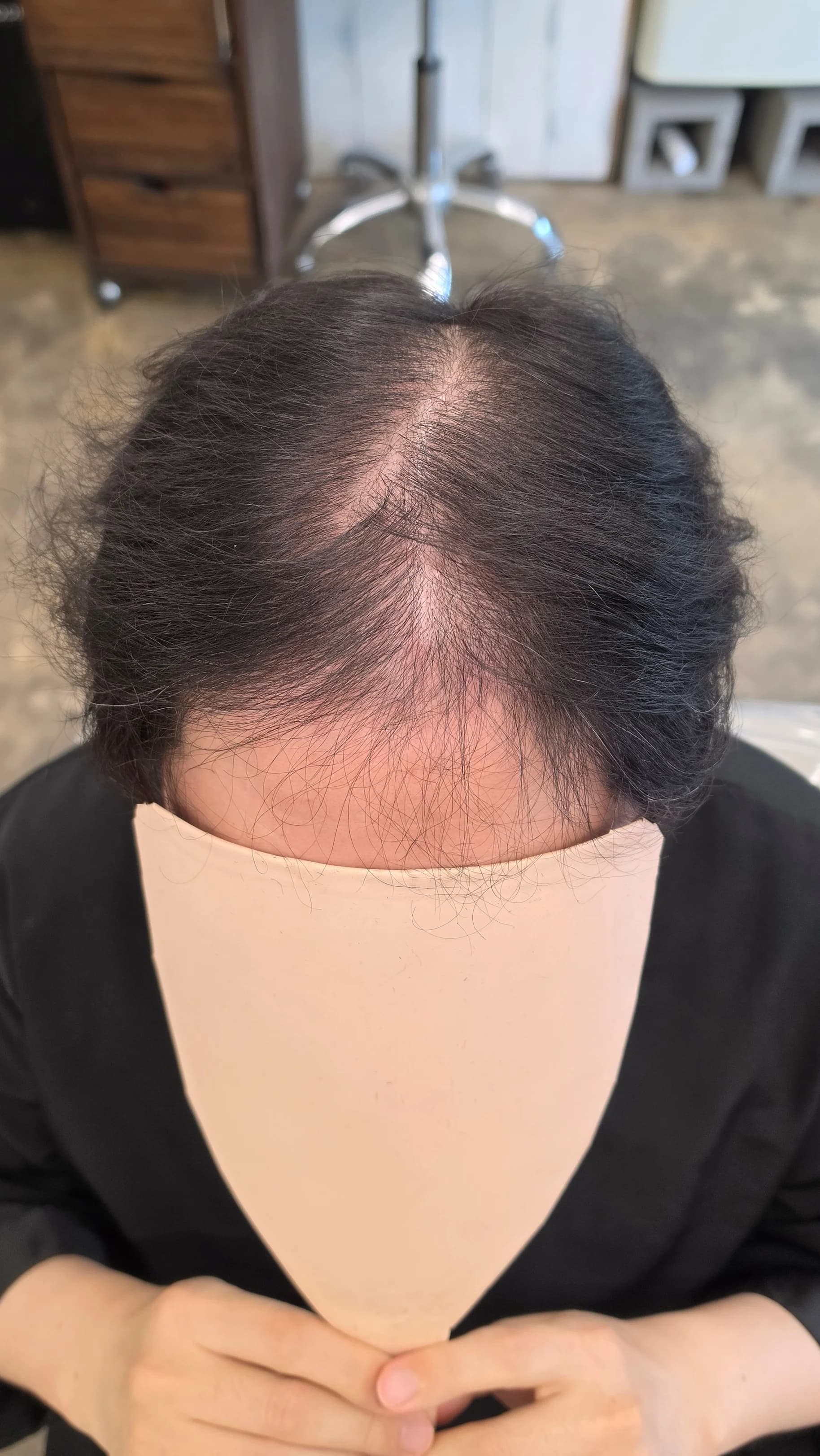 군포 금정동에서 찾아온 40대 남자, 탈모 미용실에서 자신감 찾기! 탈모펌에 빠진 이유?