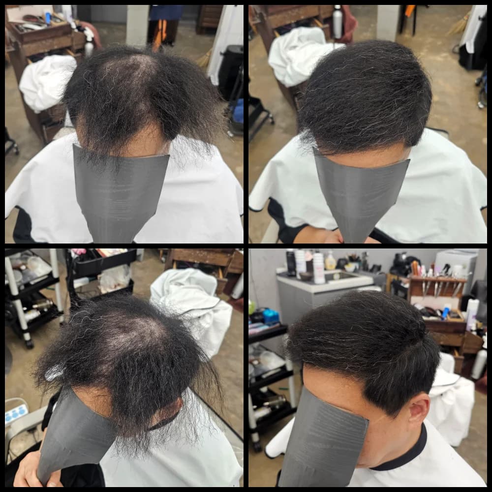 탈모 치트펌 파마