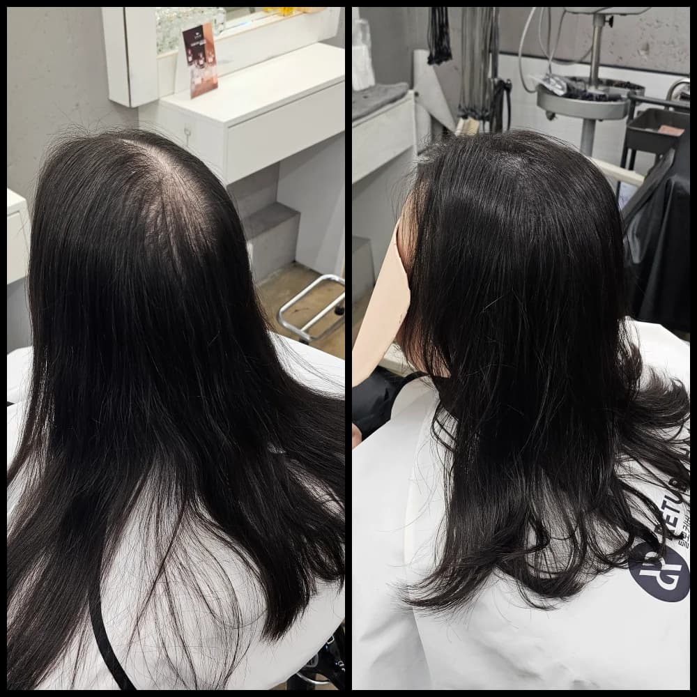 회춘펌 (뿌리볼륨 교정펌)