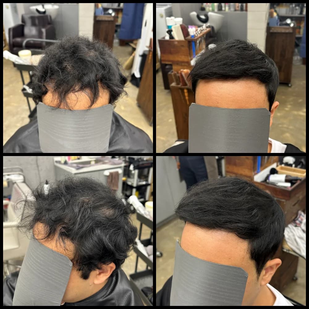 탈모 스프링매직